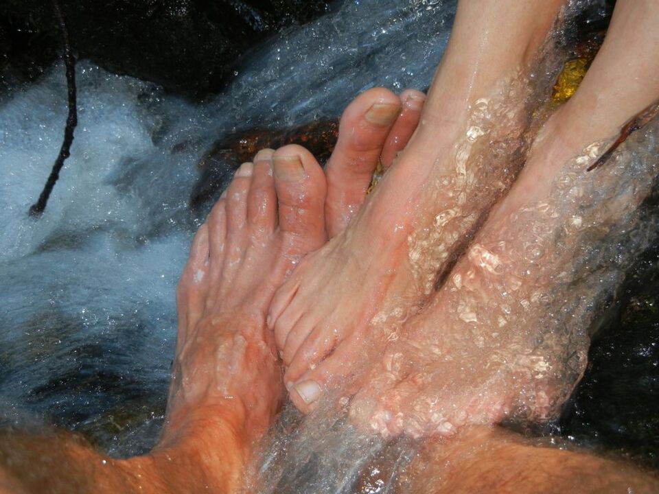 Micosi delle unghie delle gambe